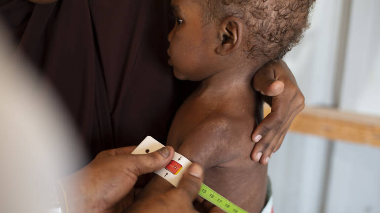 Mit dem MUAC-Band wird der Grad der Mangelernährung bei Halima ermittelt. Mit dem MUAC-Band wird der Grad der Mangelernährung bei Halima ermittelt.