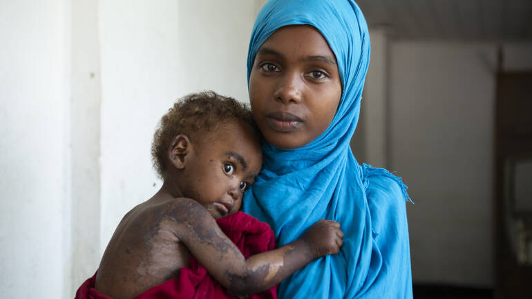 Mangelernährte Halima mit ihrer Mutter Fatuma Mangelernährte Halima mit ihrer Mutter Fatuma