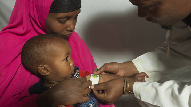 Untersuchung auf Mangelernährung Kind wird von Aktion gegen den Hunger mit MUAC Band auf Mangelernährung untersucht