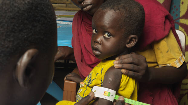 Der rote Messbereich des MUAC-Bands bedeutet akute Mangelernährung. Die Kinder sind in Lebensgefahr und müssen sofort medizinisch behandelt werden.
