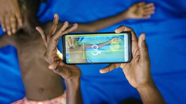 Ein Kind wird mithilfe der SAM-Foto-App auf Mangelernährung untersucht.